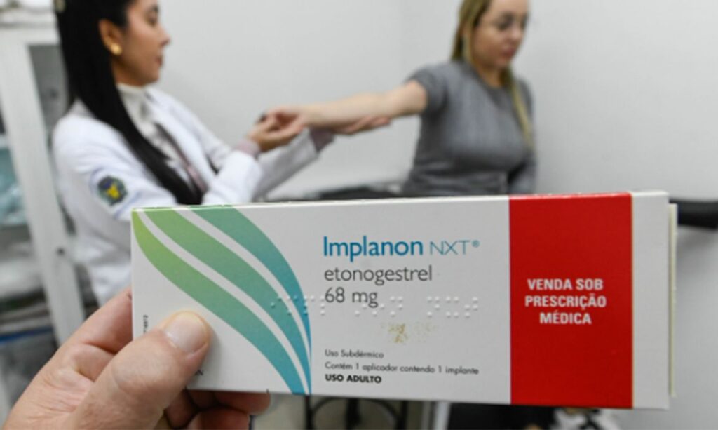 planos a partir de hoje. Implante contraceptivo hormonal será oferecido pelo SUS