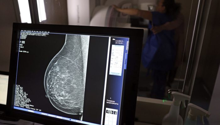 ano para realizar exames preventivos de câncer, em desconto salarial. O direito